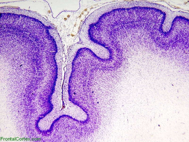 Cresyl violet immature cerebral cortex